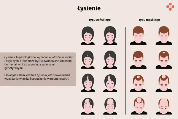 Łysienie plackowate - odrost włosów? Jak ocenić postęp