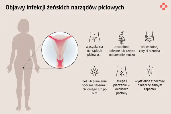 Objawy infekcji intymnej: wysypka, ból brzucha, pieczenie, wydzielina z pochwy. Ilustracja przedstawia objawy infekcji żeńskich narządów płciowych.