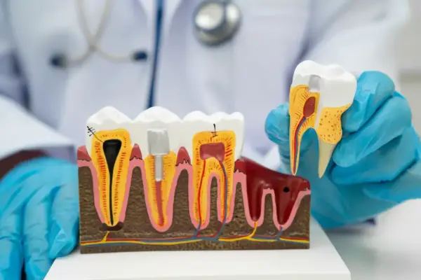 Czy dentysta boli? Jak zminimalizować ból podczas wizyty u lekarza