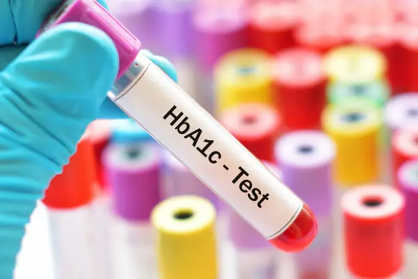 Rękawiczka trzyma probówkę z napisem "HbA1c - Test". W tle kolorowe probówki.