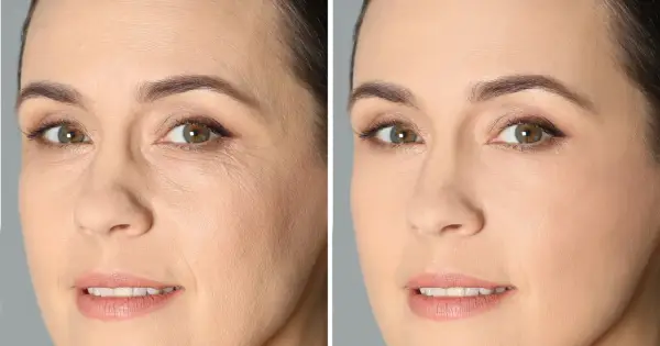 Porównanie twarzy przed i po zastosowaniu retinolu. Widoczne wygładzenie zmarszczek i poprawa tekstury skóry. Retinol efekty przed i po.