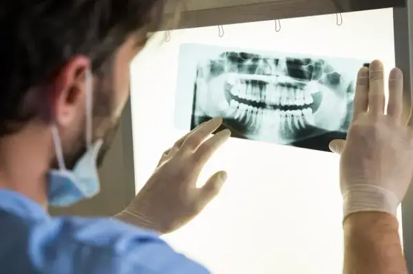 Jak często do dentysty? Pełny przewodnik: dzieci, dorośli, NFZ.