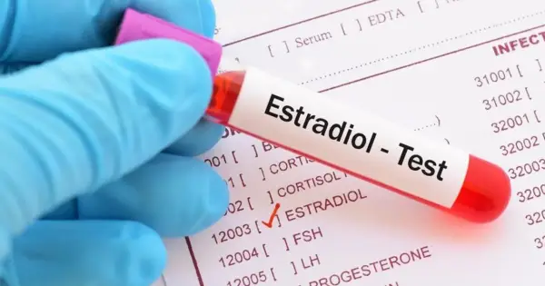 Ręka w niebieskiej rękawiczce trzyma probówkę z napisem "Estradiol - Test". Obok widoczny formularz z zaznaczonym polem ESTRADIOL, sugerującym wysoki estradiol.