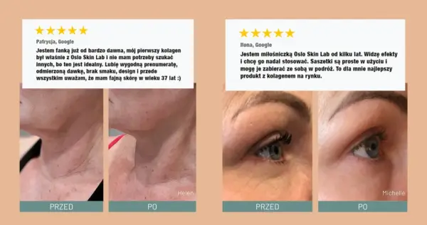 Pozytywne opinie o Oslo Skin Lab. Zdjęcia "przed" i "po" pokazują poprawę skóry. Kolagen idealny, wygodny w użyciu.