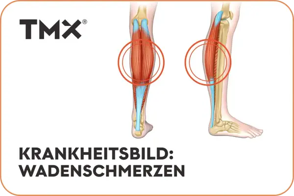 Anatomische Darstellung der Beinmuskulatur mit Hervorhebung der Wadenmuskeln. Rote Kreise markieren Bereiche, die auf **Schmerzen in der Wade** hinweisen könnten.