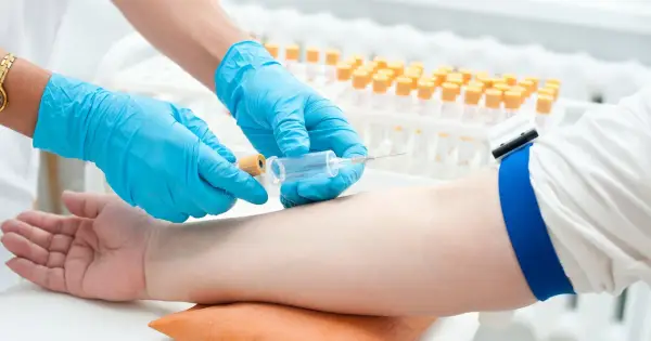 Pobieranie krwi do badań w kierunku insulinooporności. Ręka pacjenta z założonym stazą, pielęgniarka w rękawiczkach pobiera próbkę.