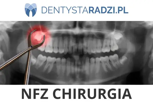 Rentgen zęba z kleszczami i zaznaczonym bólem. Napis NFZ CHIRURGIA.