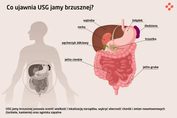 Ilustracja przedstawia narządy jamy brzusznej: wątrobę, żołądek, nerki, trzustkę, jelita, pęcherzyk żółciowy i śledzionę. USG jamy brzusznej pomaga wykryć choroby.