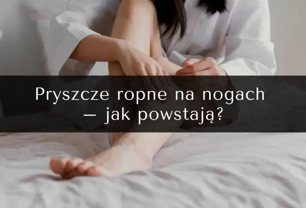 Pryszcze na nogach: przyczyny, skuteczne metody leczenia i profilaktyka