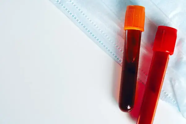 Dwie probówki z krwią, jedna z pomarańczową, druga z czerwoną zakrętką, leżą na niebieskiej masce ochronnej.