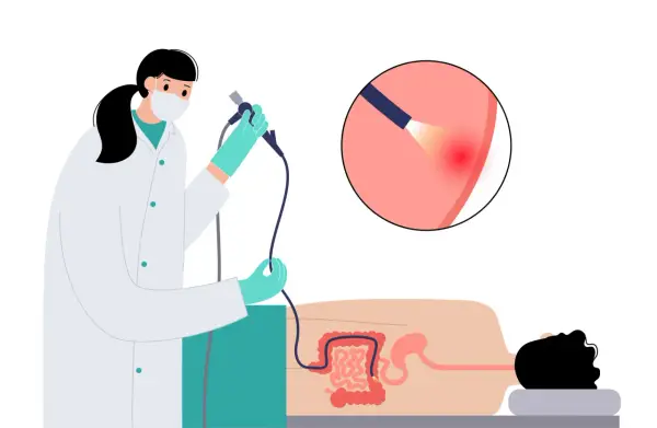 Arzt führt Darmspiegelung durch. Eine Lupe zeigt eine Entzündung im Darm. Warum nicht duschen vor Darmspiegelung? Hygiene ist wichtig.