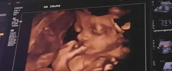 Agatowa echo serca - Kiedy warto je wykonać i jak czytać wyniki?