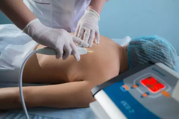 Karboksyterapia na cellulit: Skuteczna metoda na gładką skórę?
