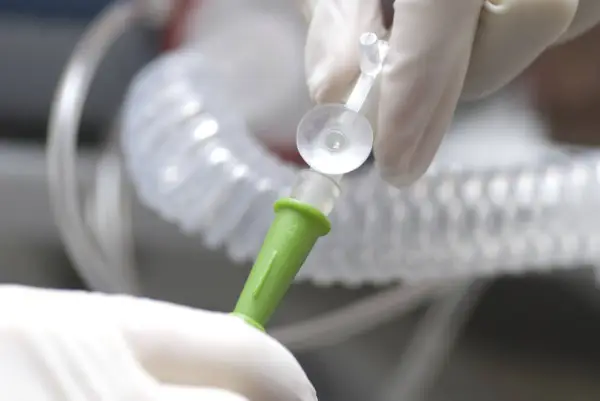 Hände in Handschuhen verbinden ein medizinisches Schlauchsystem. Mögliche Nachteile einer PEG-Sonde sind Infektionen und Verstopfungen.