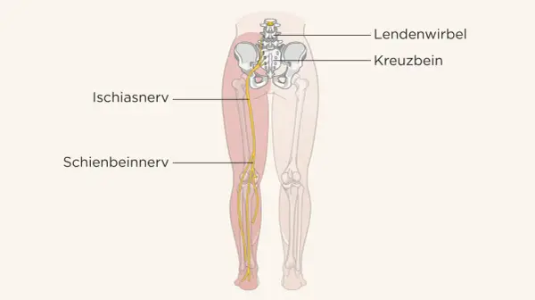 Der Ischiasnerv verläuft vom Kreuzbein durch das Bein bis zum Schienbein.