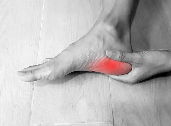 Pie con dolor en el talón, simulando fascitis plantar en niños.