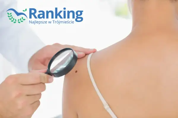 Dermatolog ogląda pieprzyk pod lupą na ramieniu pacjentki.
