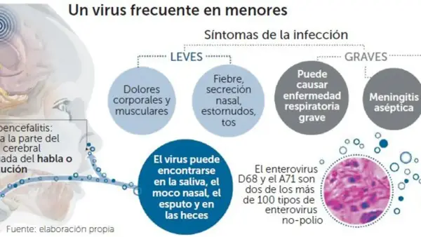 Infografía sobre enterovirus en niños, detallando síntomas leves y graves, dónde se encuentra el virus y tipos específicos como D68 y A71.