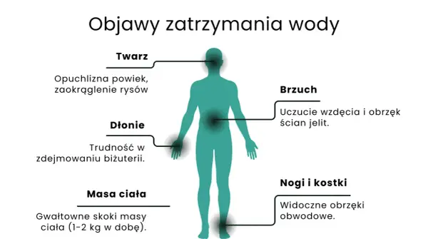 Objawy zatrzymania wody: opuchlizna twarzy, dłoni, brzucha, nóg i kostek, nagłe skoki masy ciała. Dowiedz się, jak pozbyć się wody z organizmu.