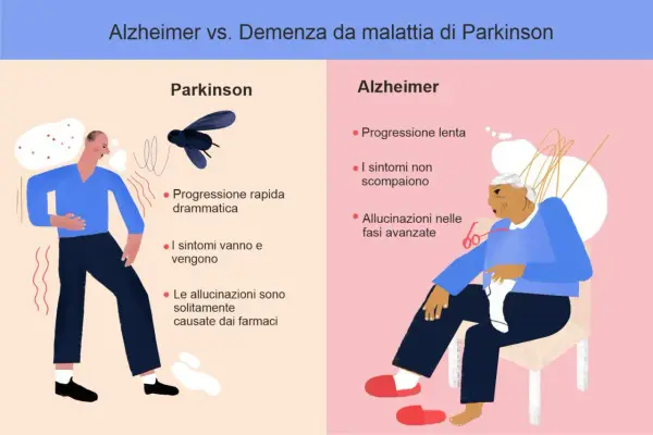 Confronto tra Parkinson e Alzheimer: progressione, sintomi e allucinazioni. Differenza tra parkinson e alzheimer illustrata con icone.