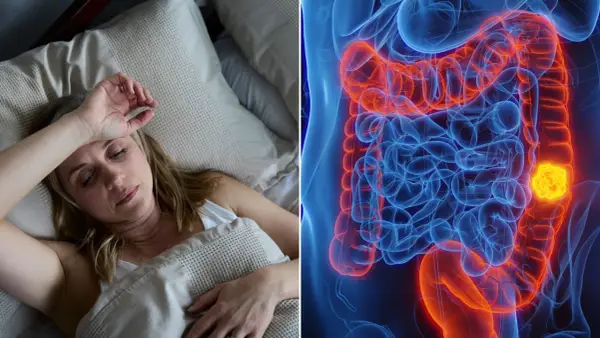Frau im Bett, erschöpft. Daneben eine 3D-Darstellung des Darms mit einem Tumor, der auf ein Darmkrebs-Endstadium hindeutet.
