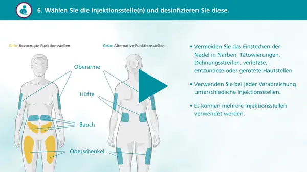 Illustration zeigt bevorzugte (gelb) und alternative (grün) Injektionsstellen am Körper, z.B. Oberschenkel.