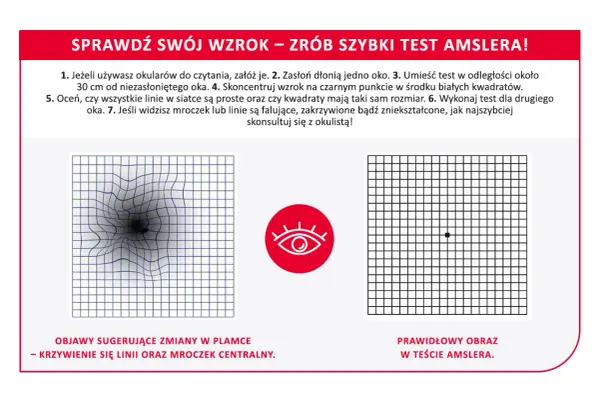 Test Amslera: zniekształcone linie i mroczek centralny to objawy sugerujące zmiany w plamce. Plamka bez refleksu co to znaczy? Skonsultuj się z okulistą.