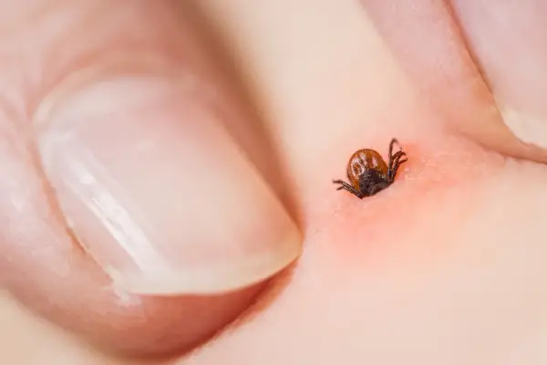 Antybiotyk po ugryzieniu kleszcza - jak długo i kiedy go brać?