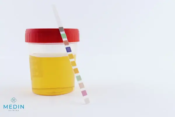 Pojemnik z żółtym płynem i paskiem testowym do analizy moczu. Kolory na pasku mogą wskazywać na różne parametry, w tym na ciemny mocz.