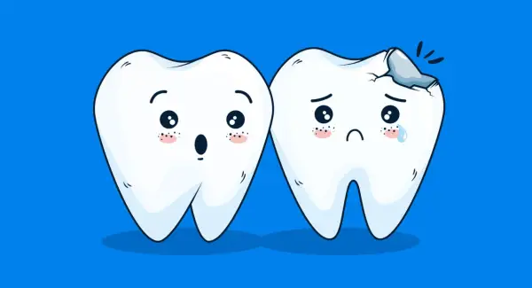 Due denti con espressioni facciali: uno sorpreso, l'altro triste con una carie. Un monito per prevenire carie e prendersi cura del proprio sorriso.