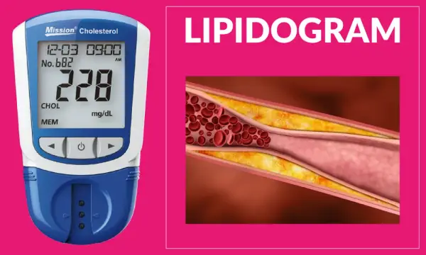 Badania na cholesterol czy na czczo? Kluczowe informacje, które musisz znać