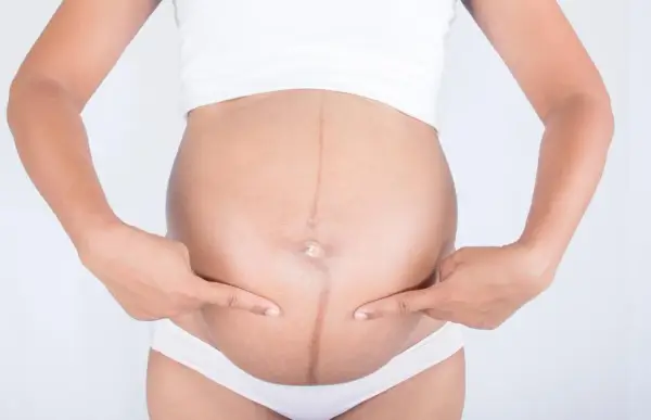 Ciężarna kobieta wskazuje palcami na ciemną linię biegnącą przez środek brzucha, zwaną linea negra.