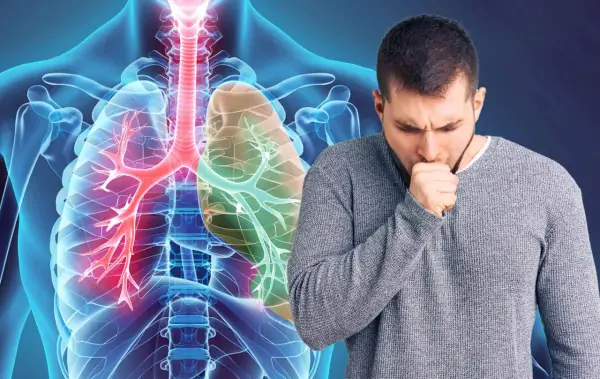 Mann hustet, Lunge mit COPD-Symptomen. Appetitlosigkeit kann ein Zeichen sein.