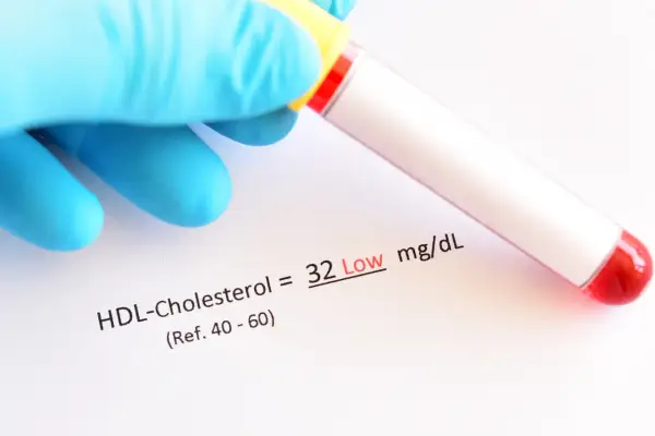 Wynik HDL-Cholesterolu to 32 mg/dL, co jest niskim wynikiem. Pamiętaj o zdrowym stylu życia, by utrzymać prawidłowy poziom **pitamet**.