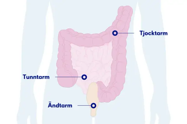 Illustration av tunntarmen, tjocktarmen och ändtarmen. Viktig för att förstå tunntarmen sjukdomar.