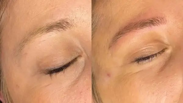 Avant/après d'un **tatouage sourcil** : les sourcils sont plus définis et remplis, offrant un regard plus intense.