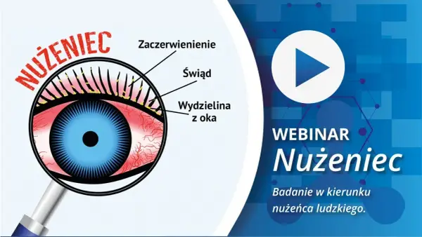 Gdzie zrobić badanie na nużeńca? Sprawdź, gdzie uzyskać wyniki szybko