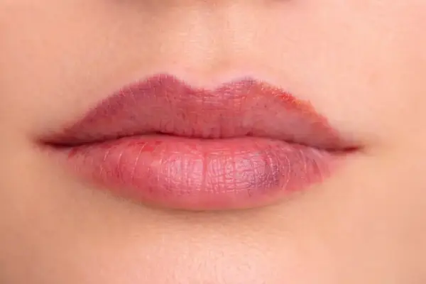 Nieudany pigment na ustach - jak go poprawić lub usunąć?