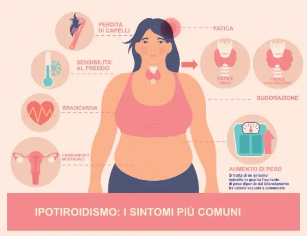 Ipotiridismo: sintomi come perdita capelli, stanchezza, aumento peso e ansia. La tiroide ipotiroidea causa questi disturbi.