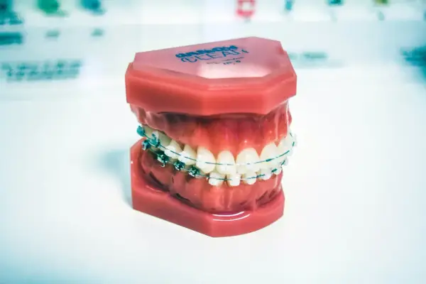 Konsultacja ortodontyczna - Co musisz wiedzieć przed wizytą?