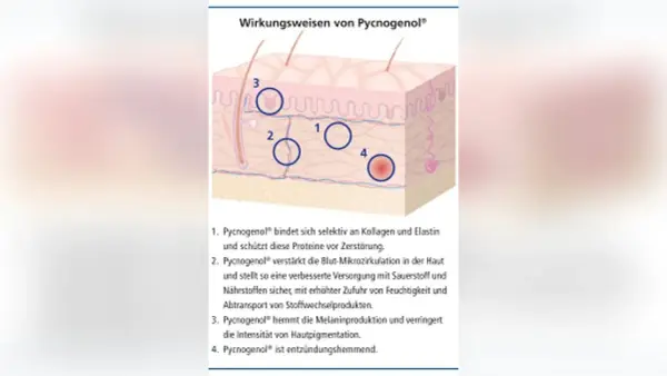 Schema zeigt Pycnogenol Wirkung bei Hautkrankheiten: schützt Kollagen, verbessert Mikrozirkulation, hemmt Pigmentierung, wirkt entzündungshemmend.