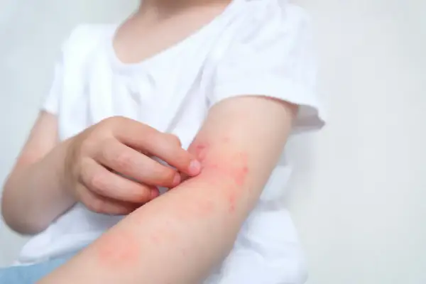 Nutramil - Kiedy ma sens? Różnice, alergia, błędy.