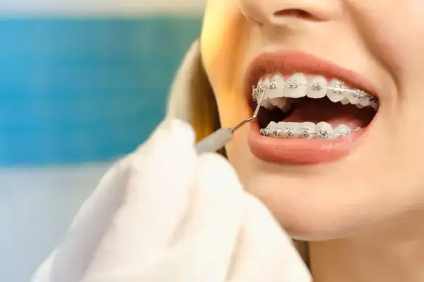 Uśmiech z aparatem na dolne zęby. Dentysta sprawdza zęby pacjentki.
