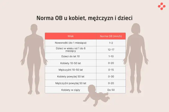 Tabela norm OB. Noworodek (do 1 miesiąca) ma normę 1-2 mm/h.