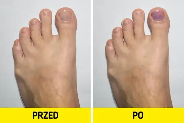 Jak bieganie zmienia sylwetkę? Odkryj sekrety metamorfozy!
