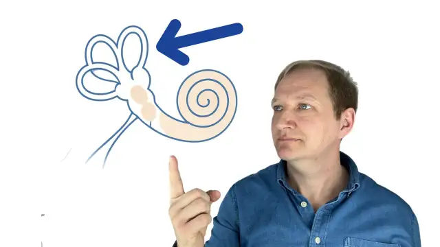 Mann zeigt auf schematische Darstellung des Innenohrs mit Pfeil.
