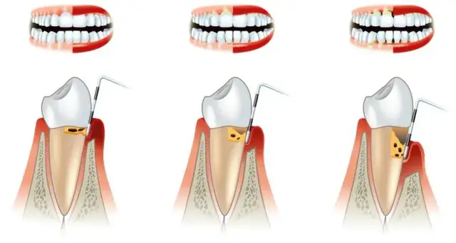 Periodontolog: Kiedy iść z dziąsłami? Przewodnik po specjalistach
