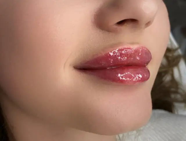 Błyszczące, pełne usta z efektem baby doll lips, podkreślone błyszczykiem.