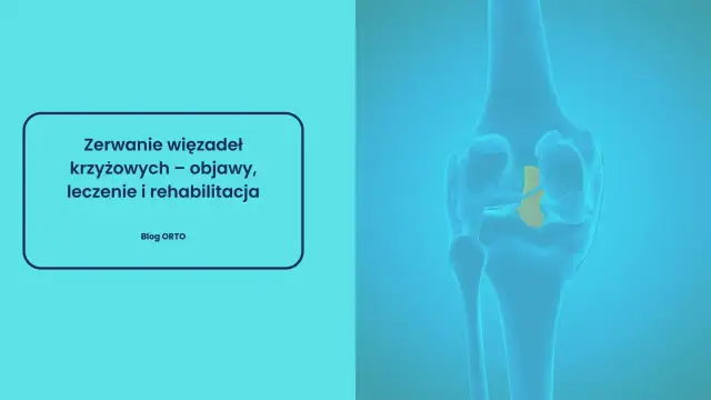Czy zerwane więzadło boli - Dlaczego ból bywa mylący? Poznaj objawy