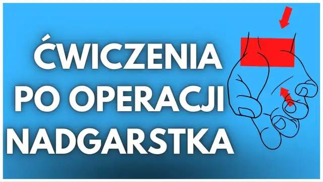 Jakie ćwiczenia po zabiegu cieśni nadgarstka pomogą w szybkiej rehabilitacji